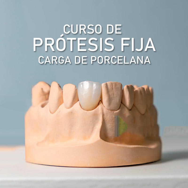 carga-de-porcelana